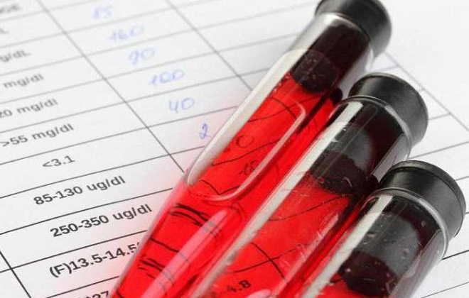 Как расшифровать анализ крови?